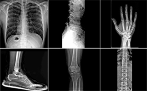 广东揭阳诊所询便携 DR：老式 X 光机升级数字化方案
