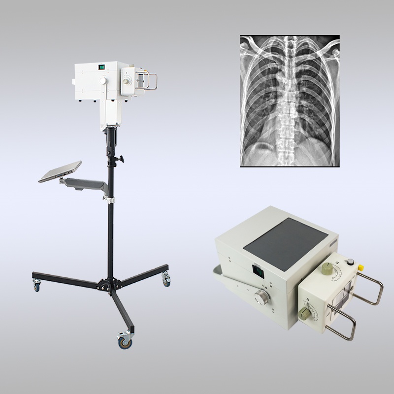  便携式dr哪家好？专业选购指南+价格影响因素解析！